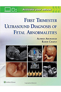 copertina di First Trimester Ultrasound Diagnosis of Fetal Abnormalities