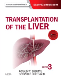 copertina di Transplantation of the Liver - Expert Consult - Online and Print