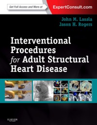 copertina di Interventional Procedures for Adult Structural Heart Disease ( Expert Consult - Online ...