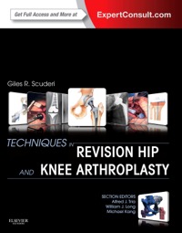 copertina di Techniques in Revision Hip and Knee Arthroplasty