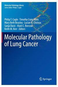 copertina di Molecular Pathology of Lung Cancer