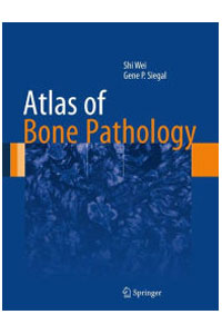 copertina di Atlas of Bone Pathology