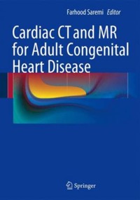 copertina di Cardiac CT ( Computed Tomography ) and MR ( Magnetic resonance imaging ) for Adult ...