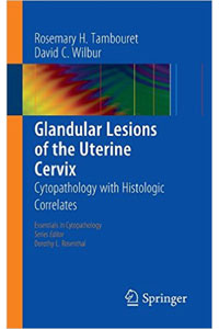 copertina di Glandular Lesions of the Uterine Cervix - Cytopathology with Histologic Correlates