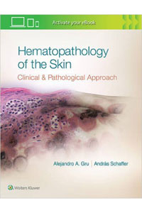 copertina di Hematopathology of the Skin: A Clinical and Pathologic Approach