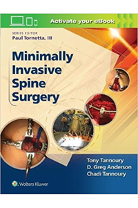 copertina di Minimally Invasive Spine Surgery