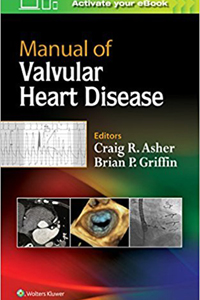 copertina di Manual of Valvular Heart Disease