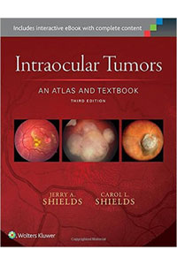 copertina di Intraocular Tumors - An atlas and text