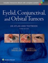 copertina di Eyelid, Conjunctival, and Orbital Tumors: An Atlas and Textbook
