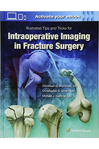 copertina di Illustrated Tips and Tricks for Intraoperative Imaging in Fracture Surgery