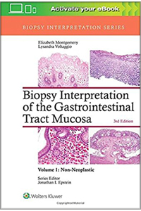 copertina di Biopsy Interpretation of the Gastrointestinal Tract Mucosa - Non - Neoplastic