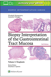 copertina di Biopsy Interpretation of the Gastrointestinal Tract Mucosa - Neoplastic