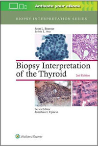 copertina di Biopsy Interpretation of the Thyroid
