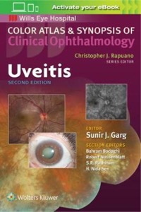 copertina di Uveitis - Color atlas and synopsis of clinical ophtalmology
