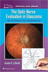 copertina di The Optic Nerve Evaluation in Glaucoma: An Interactive Workbook