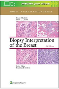 copertina di Biopsy Interpretation of the Breast