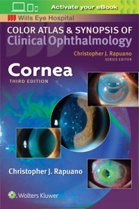 copertina di Cornea - Color atlas and synopsis of clinical ophthalmology