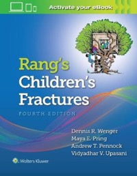 copertina di Rang' s Children' s Fractures