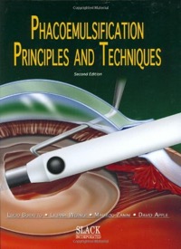 copertina di Phacoemulsification - Principles and Techniques