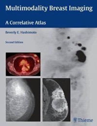 copertina di Multimodality Breast Imaging - A Correlative Atlas