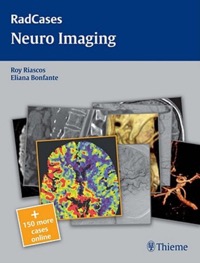 copertina di Neuro Imaging