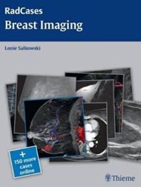 copertina di Breast Imaging