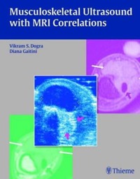 copertina di Musculoskeletal Ultrasound with MRI ( Magnetic resonance imaging ) Correlations