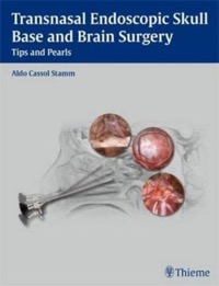 copertina di Transnasal Endoscopic Skull Base and Brain Surgery - Tips and Pearls