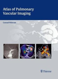 copertina di Atlas of Pulmonary Vascular Imaging  - A Multimodality Approach 