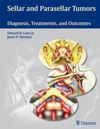 copertina di Sellar and Parasellar Tumors - Diagnosis, Treatments, and Outcomes