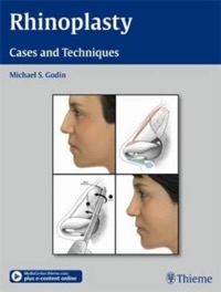 copertina di Rhinoplasty - Cases and Techniques