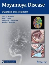 copertina di Moyamoya Disease - Diagnosis and Treatment