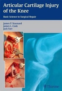 copertina di Articular Cartilage Injury of the Knee : Basic Science to Surgical Repair
