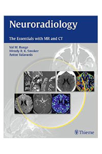 copertina di Neuroradiology - The Essentials with MR ( Magnetic Resonance ) and CT ( Computed ...