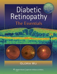 copertina di Diabetic Retinopathy : The Essentials