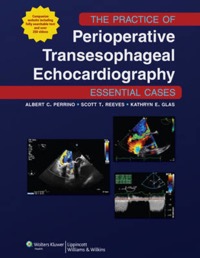 copertina di The Practice of Perioperative Transesophageal Echocardiography  - on line access ...