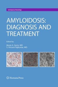 copertina di Amyloidosis - Diagnosis and Treatment