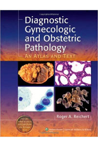 copertina di Diagnostic Gynecologic and Obstetric Pathology