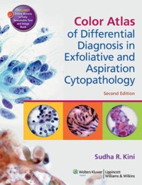 copertina di Differential Diagnosis in Exfoliative and Aspiration Cytopathology : An Atlas and ...