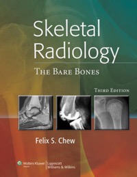 copertina di Skeletal Radiology : The Bare Bones