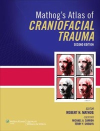 copertina di Mathog' s Atlas of Craniofacial Trauma