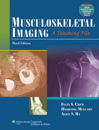 copertina di Musculoskeletal Imaging : A Teaching File