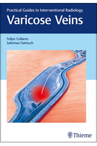 copertina di Varicose Veins - Practical Guides in Interventional Radiology