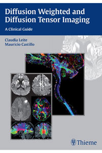copertina di Diffusion Weighted and Diffusion Tensor Imaging - A Clinical Guide