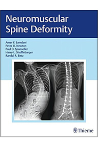 copertina di Neuromuscular Spine Deformity