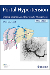 copertina di Portal Hypertension - Imaging, Diagnosis, and Endovascular Management