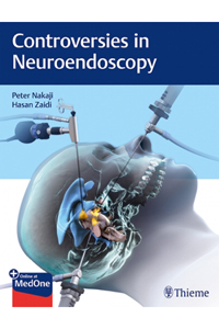 copertina di Controversies in Neuroendoscopy