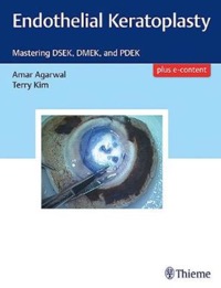 copertina di Endothelial Keratoplasty - Mastering DSEK, DMEK, and PDEK