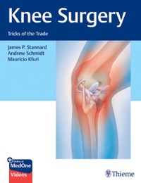 copertina di Knee Surgery : Tricks of the Trade