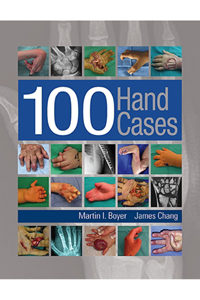 copertina di 100 Hand Cases